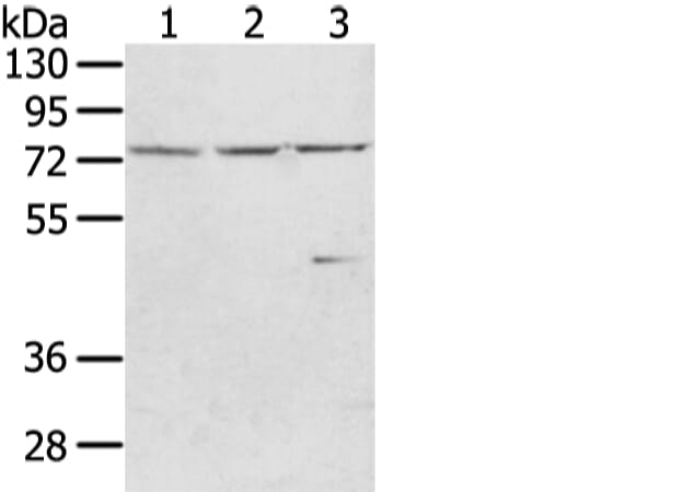 Gel: 8% SDS-PAGE Lysate: 40 &#956;g Lane 1-3: HT-29, hela and A431 cell Primary antibody: 1/400 dilution Secondary antibody: Goat anti rabbit IgG at 1/8000 dilution Exposure time: 10 seconds