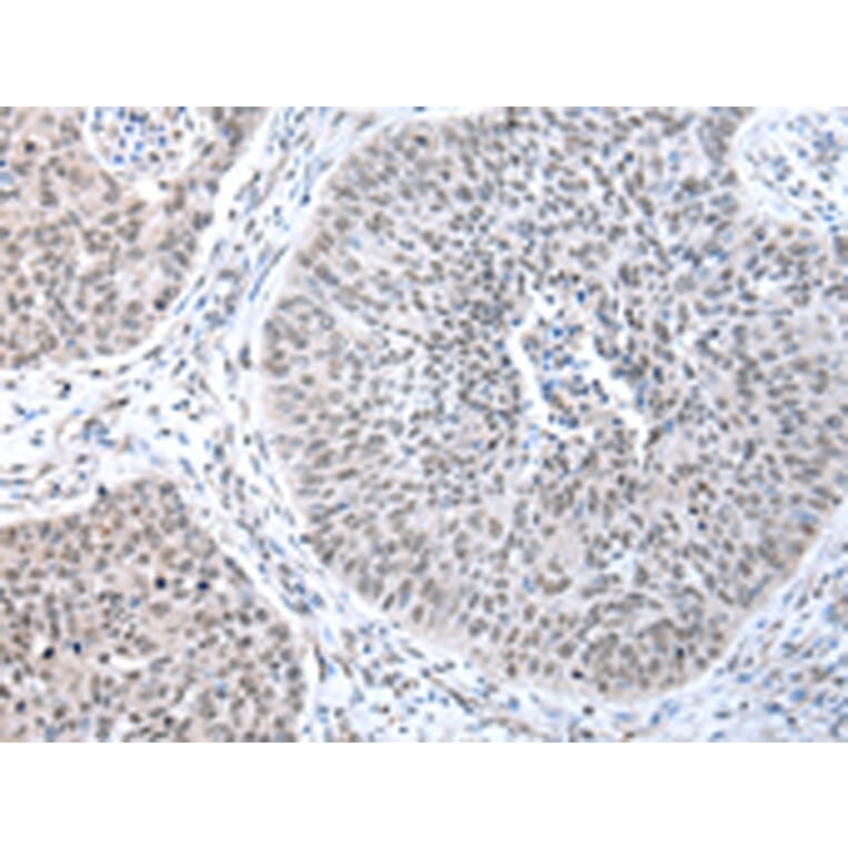 Immunohistochemistry - WRAP53 Antibody from Signalway Antibody (43348) - Antibodies.com