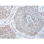 Immunohistochemistry - WRAP53 Antibody from Signalway Antibody (43348) - Antibodies.com