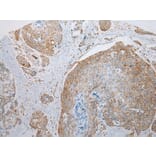 Immunohistochemistry - NDUFB6 Antibody from Signalway Antibody (43351) - Antibodies.com