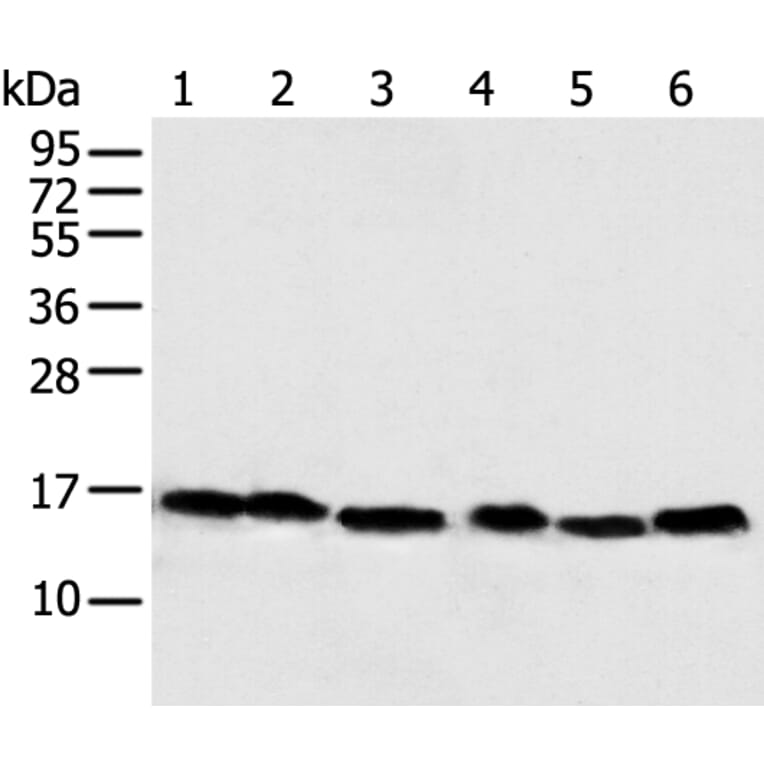 NDUFB6 Antibody from Signalway Antibody (43351) - Antibodies.com