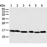 NDUFB6 Antibody from Signalway Antibody (43351) - Antibodies.com