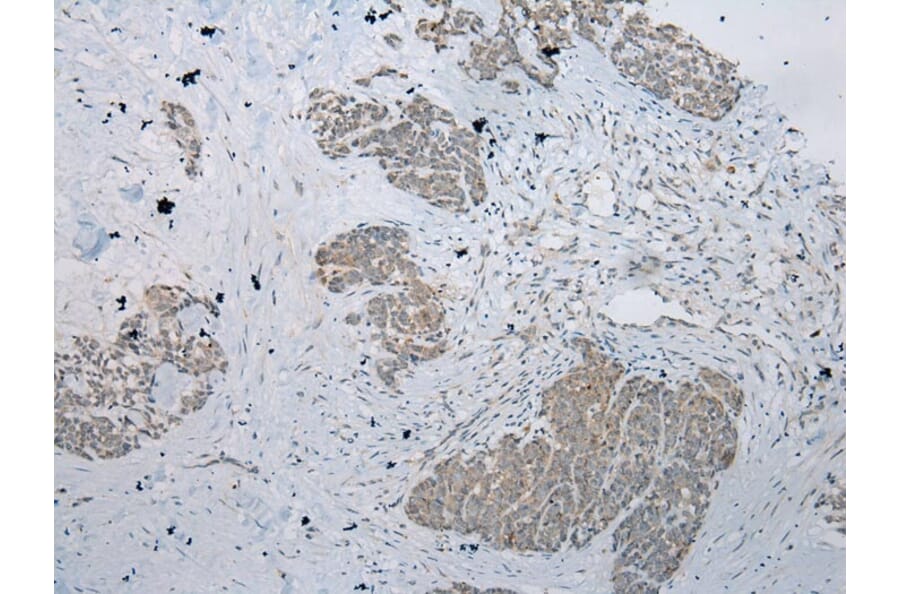 Immunohistochemistry - RPL35A Antibody from Signalway Antibody (43356) - Antibodies.com