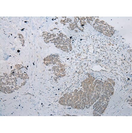 Immunohistochemistry - RPL35A Antibody from Signalway Antibody (43356) - Antibodies.com