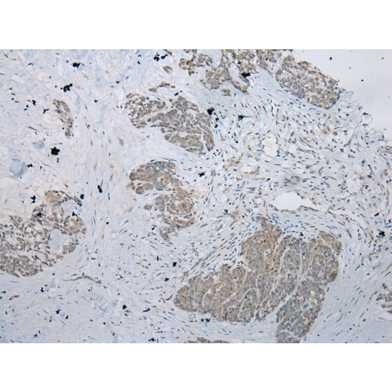 Immunohistochemistry - RPL35A Antibody from Signalway Antibody (43356) - Antibodies.com