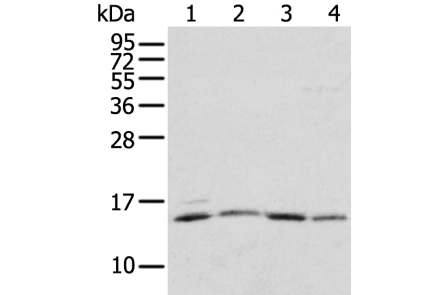 RPL35A Antibody from Signalway Antibody (43356) - Antibodies.com