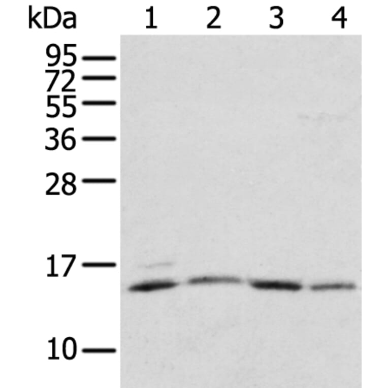 RPL35A Antibody from Signalway Antibody (43356) - Antibodies.com