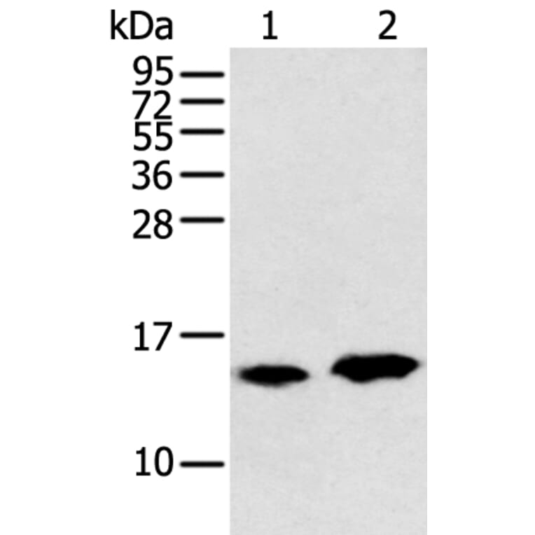 CARTPT Antibody from Signalway Antibody (43358) - Antibodies.com