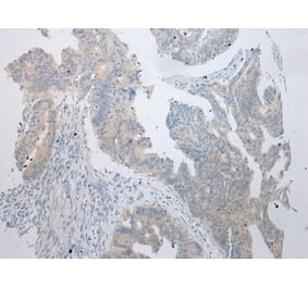 Immunohistochemistry - RPS15A Antibody from Signalway Antibody (43359) - Antibodies.com