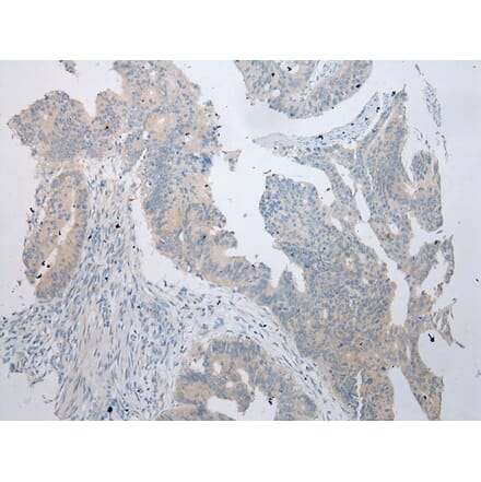 Immunohistochemistry - RPS15A Antibody from Signalway Antibody (43359) - Antibodies.com