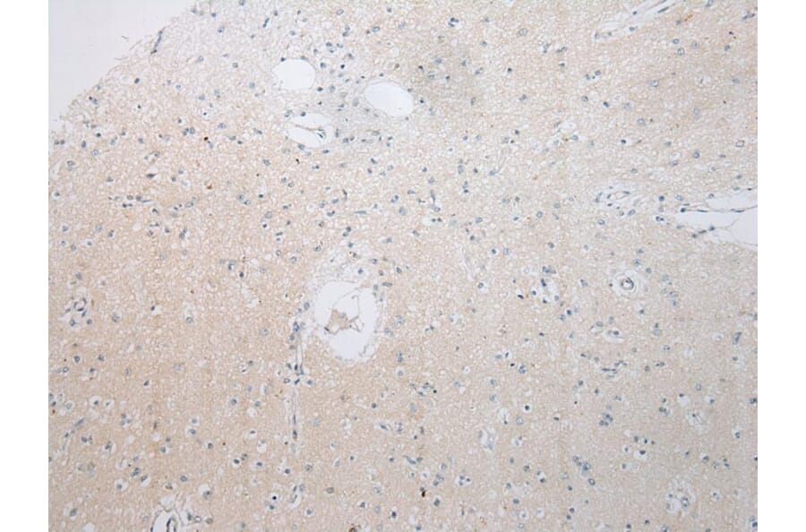 Immunohistochemistry - RPS15A Antibody from Signalway Antibody (43359) - Antibodies.com