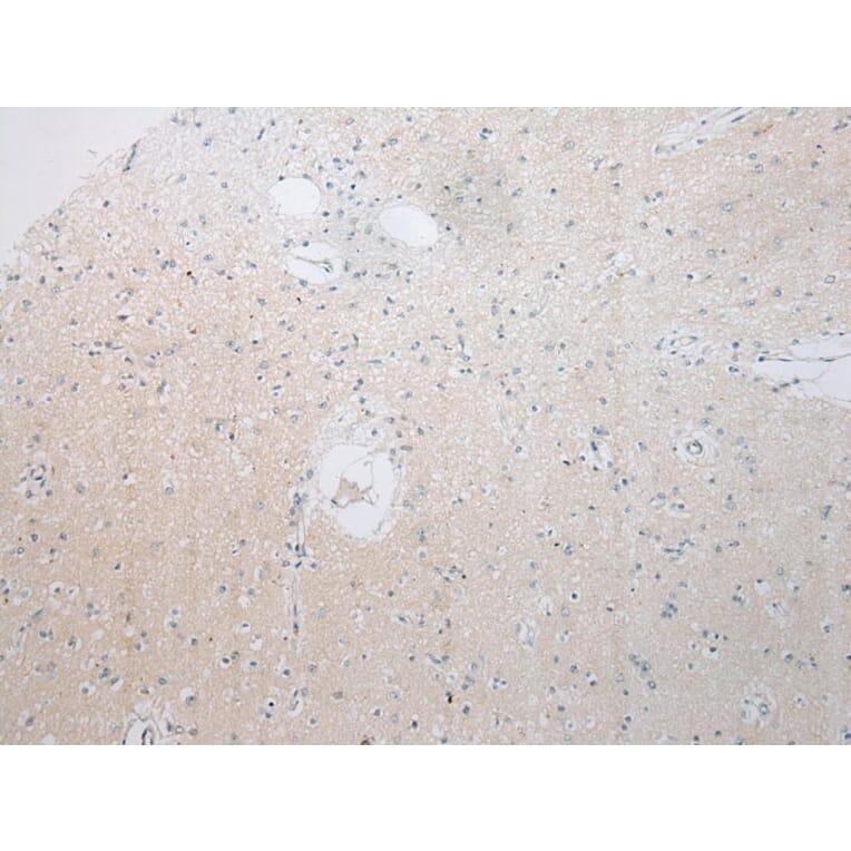 Immunohistochemistry - RPS15A Antibody from Signalway Antibody (43359) - Antibodies.com