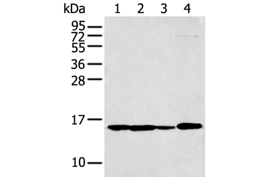 RPS15A Antibody from Signalway Antibody (43359) - Antibodies.com