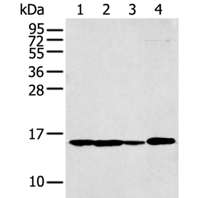 RPS15A Antibody from Signalway Antibody (43359) - Antibodies.com
