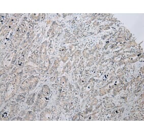 Immunohistochemistry - ZNF621 Antibody from Signalway Antibody (43363) - Antibodies.com