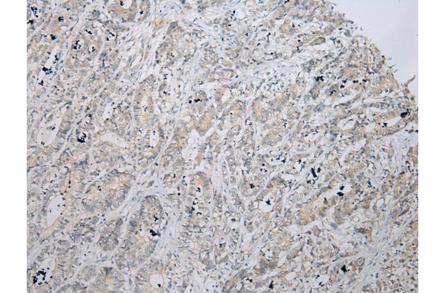 Immunohistochemistry - ZNF621 Antibody from Signalway Antibody (43363) - Antibodies.com