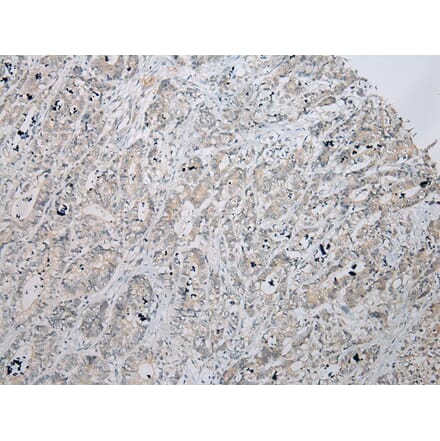 Immunohistochemistry - ZNF621 Antibody from Signalway Antibody (43363) - Antibodies.com