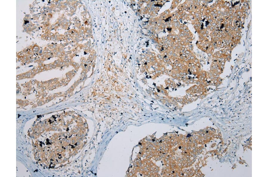 Immunohistochemistry - ZNF621 Antibody from Signalway Antibody (43363) - Antibodies.com