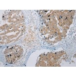 Immunohistochemistry - ZNF621 Antibody from Signalway Antibody (43363) - Antibodies.com