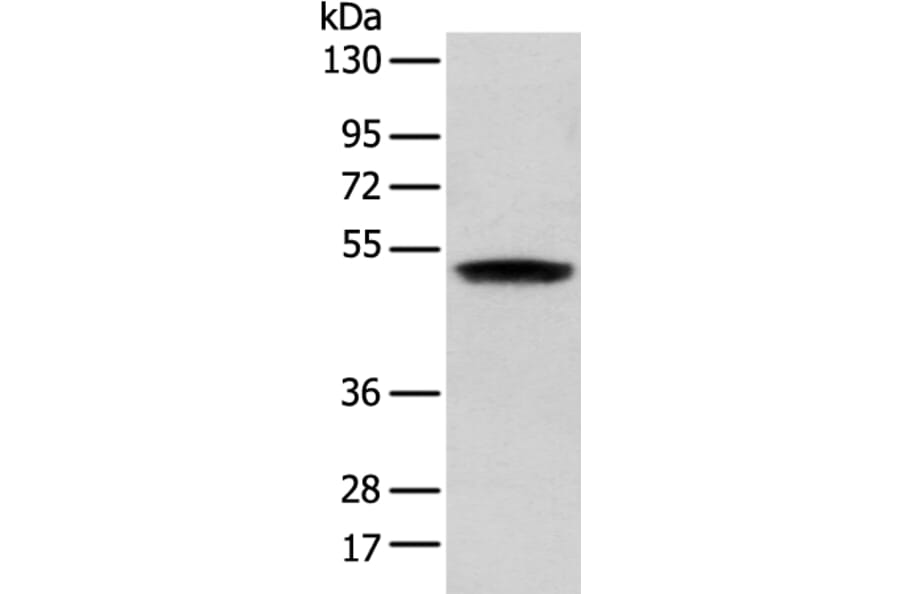 ZNF621 Antibody from Signalway Antibody (43363) - Antibodies.com