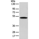ZNF621 Antibody from Signalway Antibody (43363) - Antibodies.com