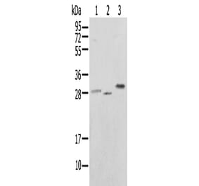UBE2J2 Antibody from Signalway Antibody (43366) - Antibodies.com