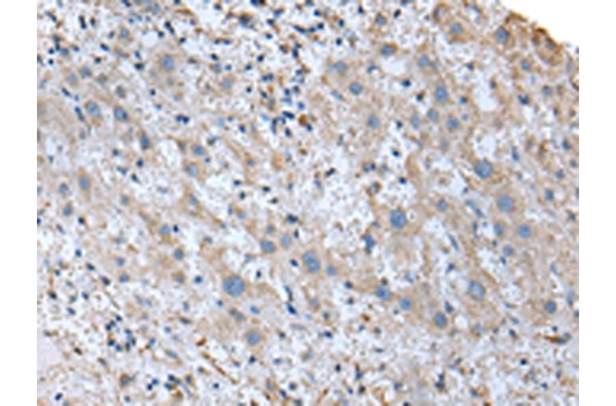Immunohistochemistry - UBE2J2 Antibody from Signalway Antibody (43366) - Antibodies.com