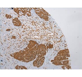 Immunohistochemistry - ZNF248 Antibody from Signalway Antibody (43372) - Antibodies.com