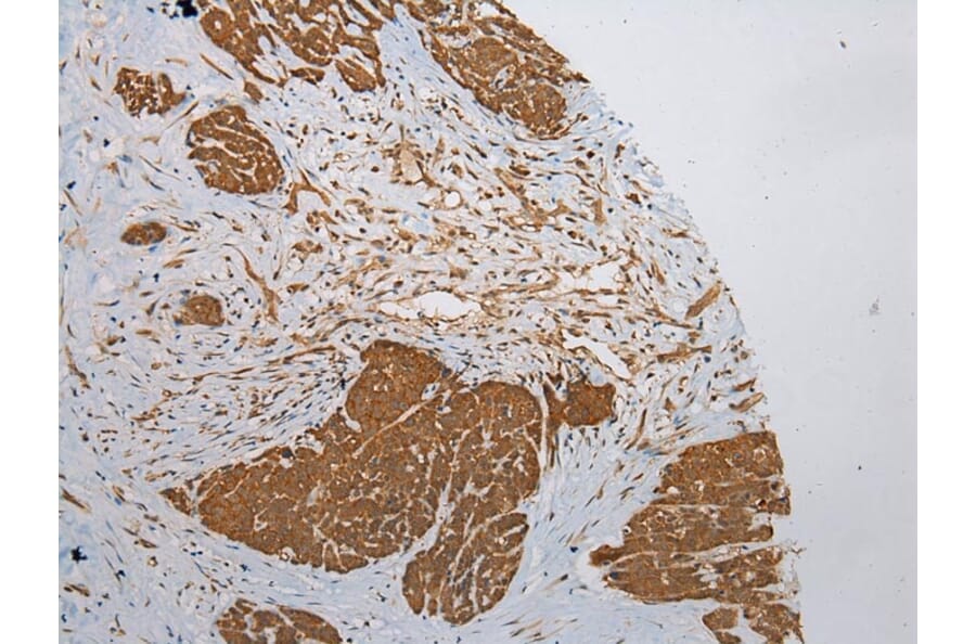 Immunohistochemistry - ZNF248 Antibody from Signalway Antibody (43372) - Antibodies.com