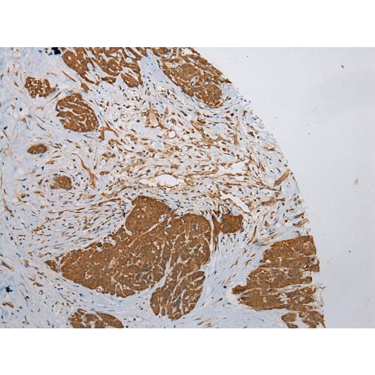 Immunohistochemistry - ZNF248 Antibody from Signalway Antibody (43372) - Antibodies.com