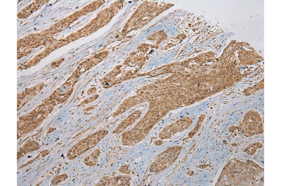 Immunohistochemistry - ZNF248 Antibody from Signalway Antibody (43372) - Antibodies.com