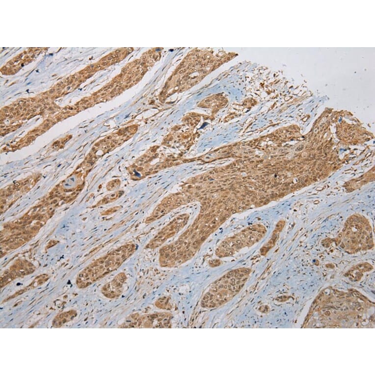 Immunohistochemistry - ZNF248 Antibody from Signalway Antibody (43372) - Antibodies.com