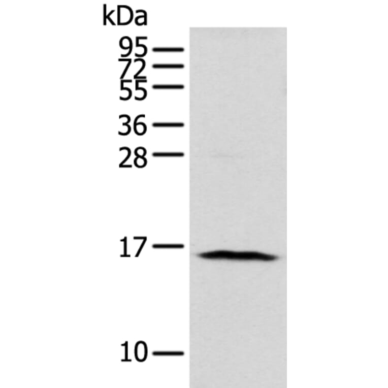 NUDT10 Antibody from Signalway Antibody (43375) - Antibodies.com