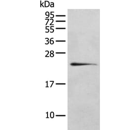 RILPL2 Antibody from Signalway Antibody (43385) - Antibodies.com