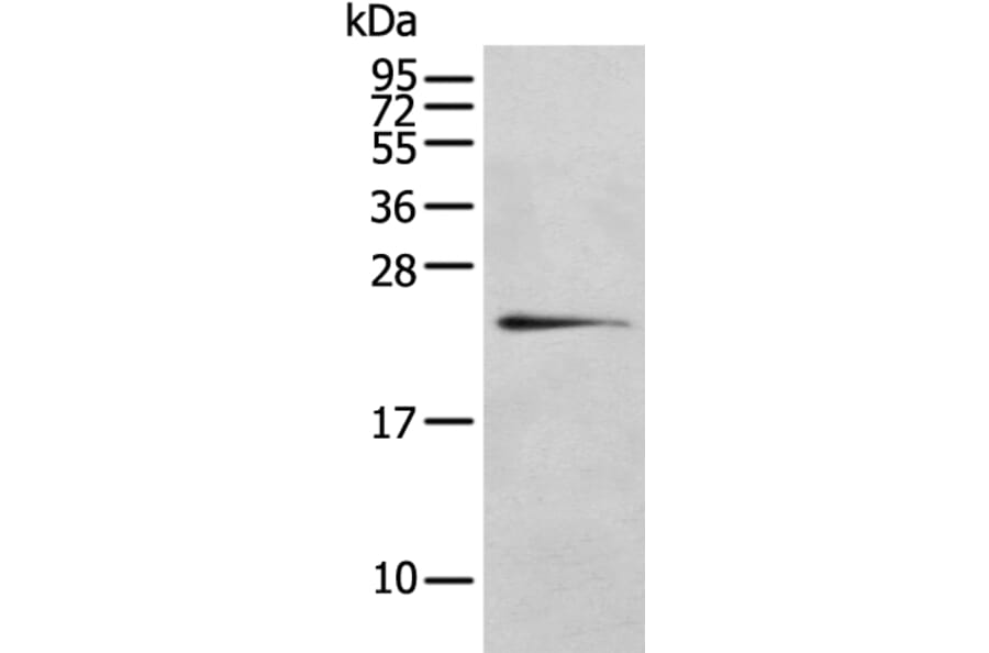 RILPL2 Antibody from Signalway Antibody (43385) - Antibodies.com