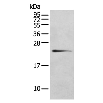 RILPL2 Antibody from Signalway Antibody (43385) - Antibodies.com