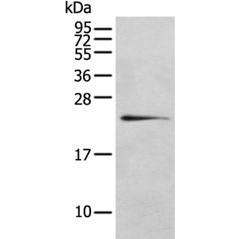 RILPL2 Antibody from Signalway Antibody (43385) - Antibodies.com