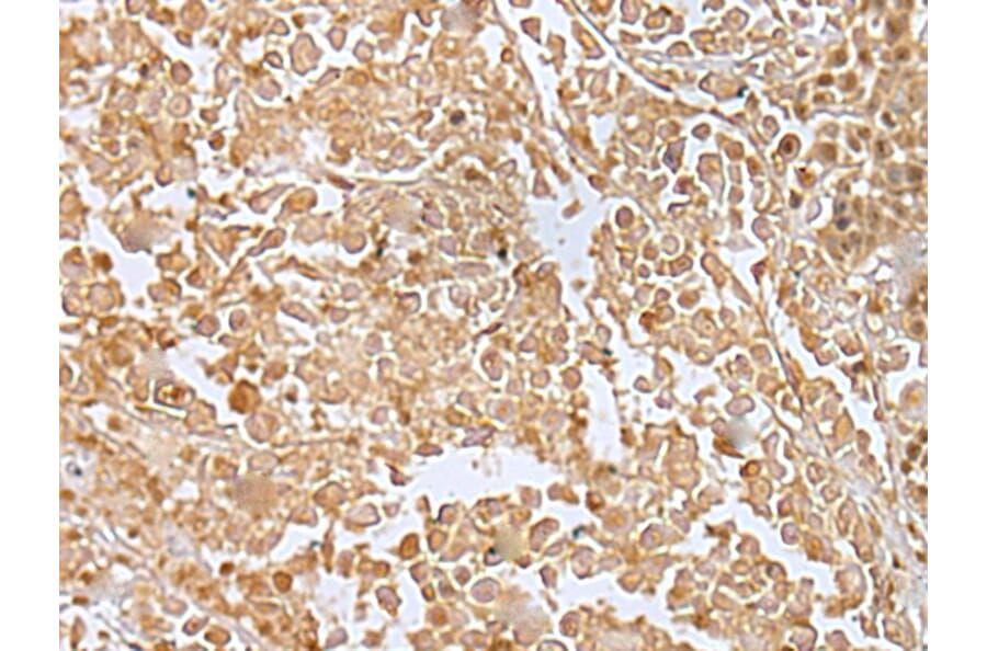 Immunohistochemistry - RILPL2 Antibody from Signalway Antibody (43385) - Antibodies.com