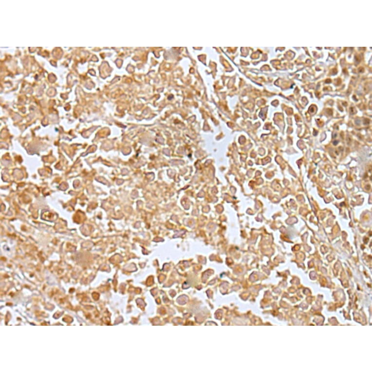 Immunohistochemistry - RILPL2 Antibody from Signalway Antibody (43385) - Antibodies.com