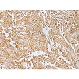 Immunohistochemistry - RILPL2 Antibody from Signalway Antibody (43385) - Antibodies.com