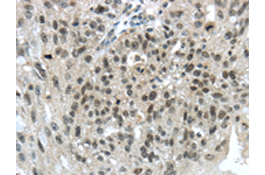 Immunohistochemistry - TRIM24 Antibody from Signalway Antibody (43420) - Antibodies.com