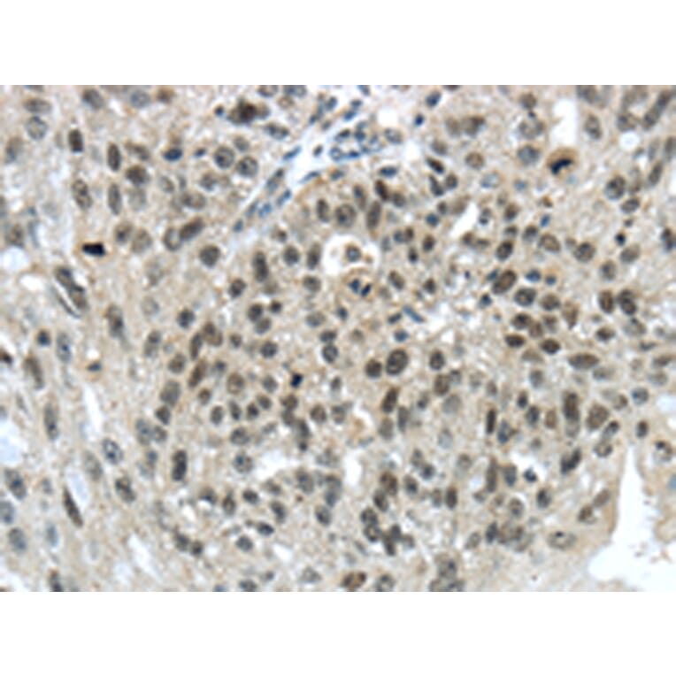 Immunohistochemistry - TRIM24 Antibody from Signalway Antibody (43420) - Antibodies.com