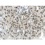 Immunohistochemistry - TRIM24 Antibody from Signalway Antibody (43420) - Antibodies.com