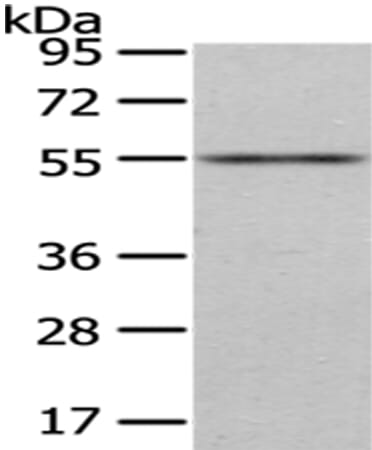 Gel: 8% SDS-PAGE Lysate: 40 &#956;g Lane: Mouse heart tissue Primary antibody: 1/200 dilution Secondary antibody: Goat anti rabbit IgG at 1/8000 dilution Exposure time: 1 minute