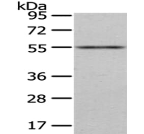 ENTPD1 Antibody from Signalway Antibody (43433) - Antibodies.com