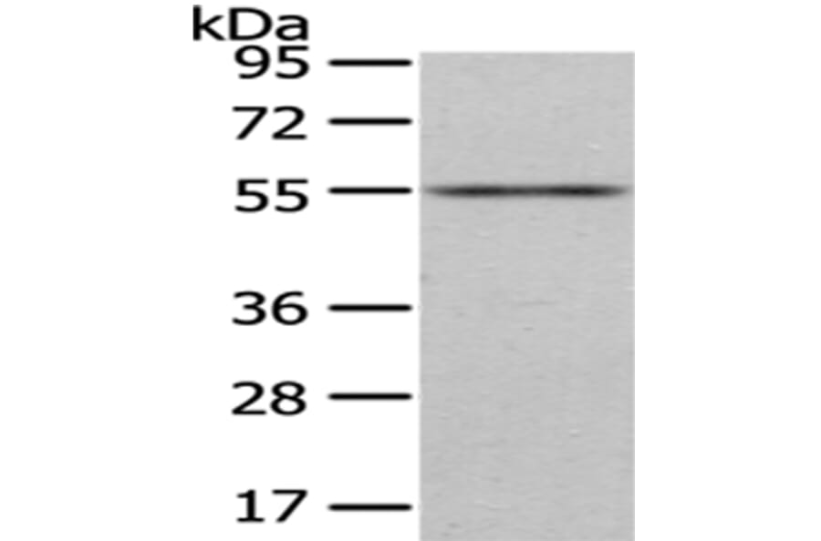 ENTPD1 Antibody from Signalway Antibody (43433) - Antibodies.com