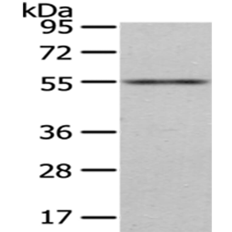 ENTPD1 Antibody from Signalway Antibody (43433) - Antibodies.com