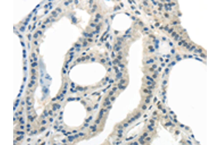 Immunohistochemistry - ENTPD1 Antibody from Signalway Antibody (43433) - Antibodies.com