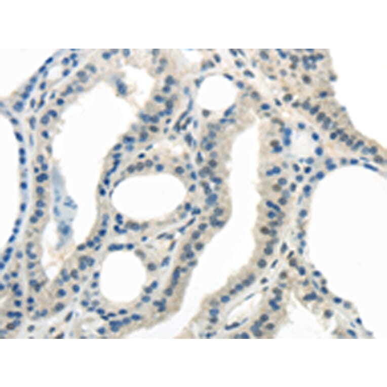 Immunohistochemistry - ENTPD1 Antibody from Signalway Antibody (43433) - Antibodies.com