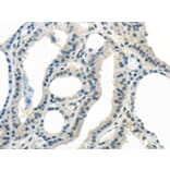 Immunohistochemistry - ENTPD1 Antibody from Signalway Antibody (43433) - Antibodies.com